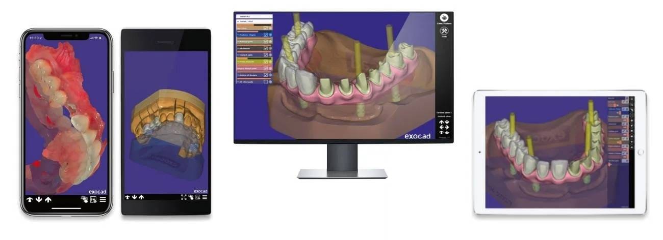 exocad DentalCAD devices