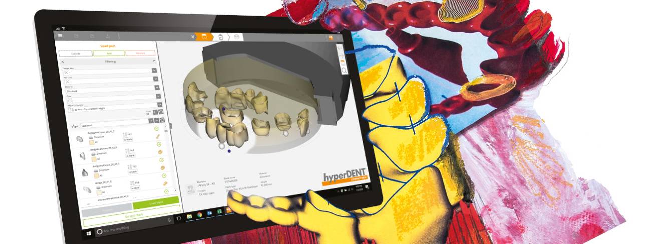 Hyperdent dental CAM software